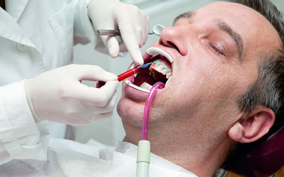 Услуги отбеливания зубов - Медикус